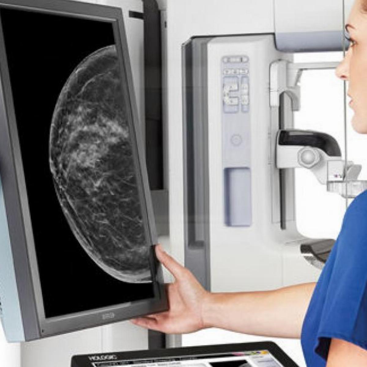 Маммография рентген